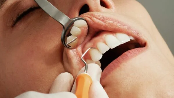 Four Tips To Keep Your Teeth Healthy And Rule Out Dental Issues