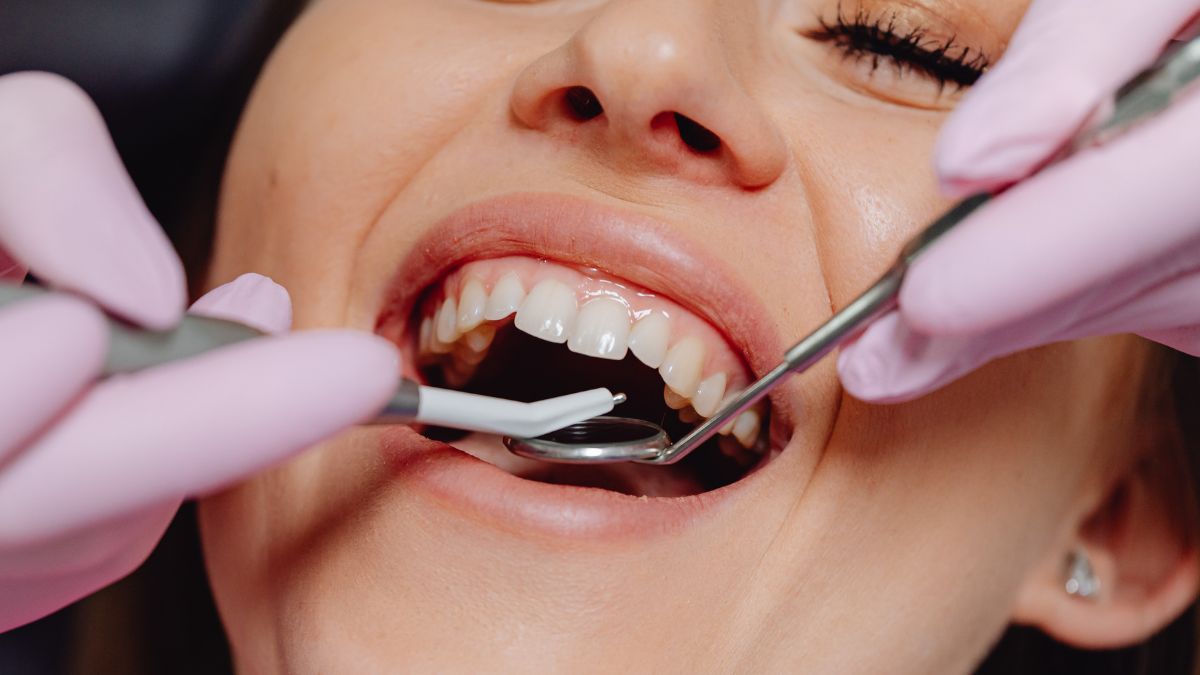 Tips To Keep Your Teeth Healthy And Rule Out Dental Issues