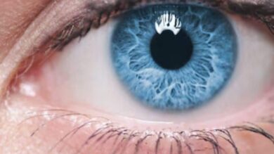 Understanding Glaucoma: Causes, Symptoms, Treatment, and Prevention Tips